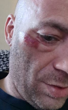 <img src="image.png" alt=""> Mein Gesicht am nächsten Tag