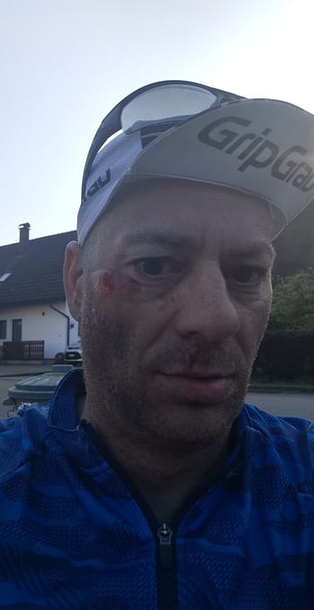 <img src="image.png" alt=""> Bisschen verwirrt und durcheinander nach dem Sturz